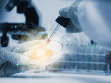 Patient-derived nerve cells