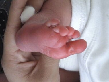 newborns and screenings for Pompe disease