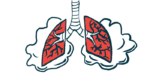 An illustration of lungs laboring to breathe.
