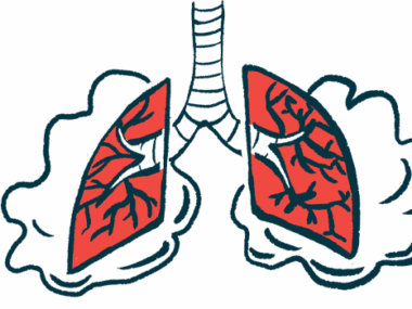 An illustration of lungs laboring to breathe.