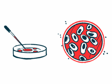 synthesis of glycogen | Pompe Disease News | illustration of petri dish