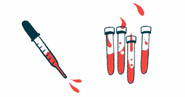 An illustration of a syringe filled with blood next to three blood vials.