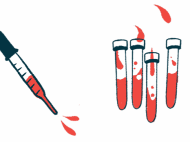 An illustration of a syringe filled with blood next to three blood vials.