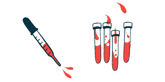 An illustration of a syringe filled with blood next to three blood vials.