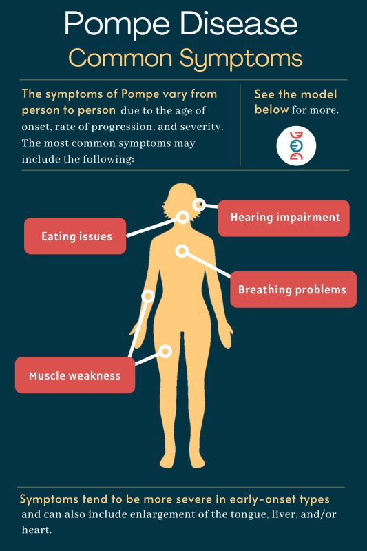 Pompe disease symptoms | Pompe Disease News | infographic depicting common symptoms of Pompe disease
