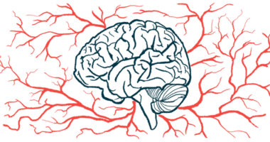 The human brain is surrounded by blood vessels in this close-up illustration.