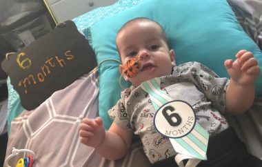 A 6-month-old baby lies in a bed on a blue pillow, next to another pillow that says "6 months." He has a cute tie that says "6 months," and a feeding tube is visible going into his nose.
