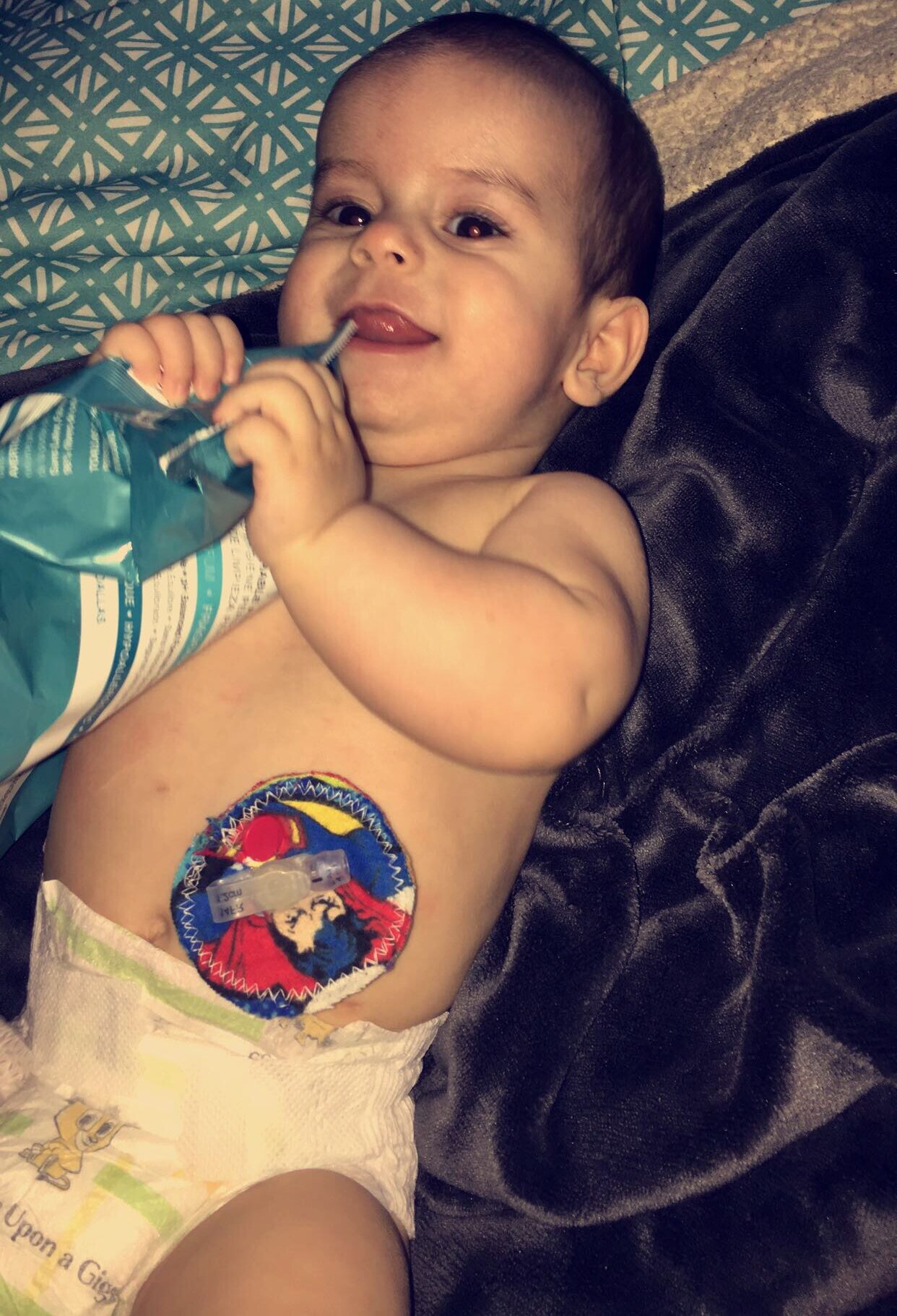 how-g-tube-feeding-is-beneficial-for-my-son-with-pompe-disease